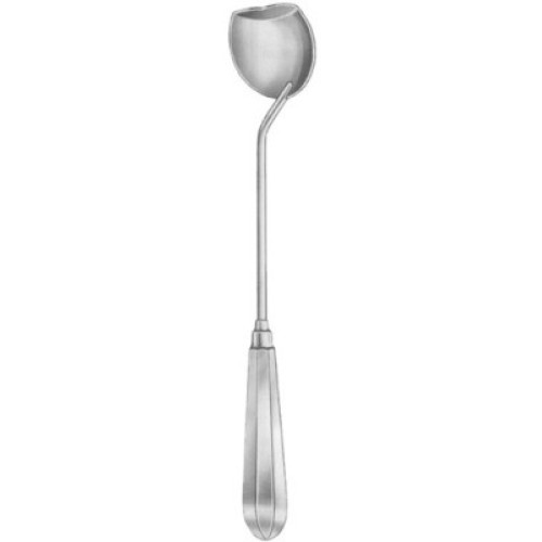 Moore Gall Stone Scoops 28cm/11"